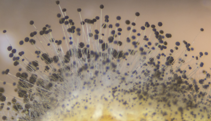 Hongo de moho al microscopio
